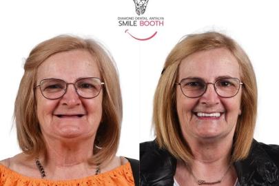 PORTEKİZ'DE ÇÖZÜM BULAMADI, ANTALYA'DA HAYATİ DEĞİŞİM YAŞADI