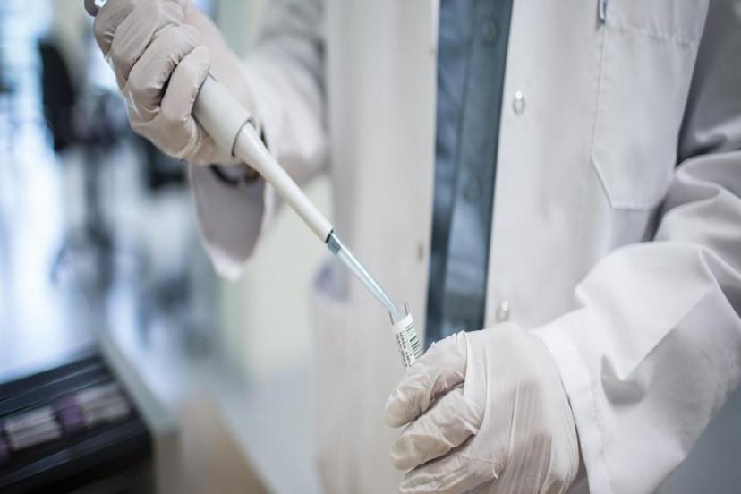 HIV/AIDS'E YÖNELİK GÖNÜLLÜ TEST MERKEZLERİNİN SAYISI 10'A ULAŞIYOR