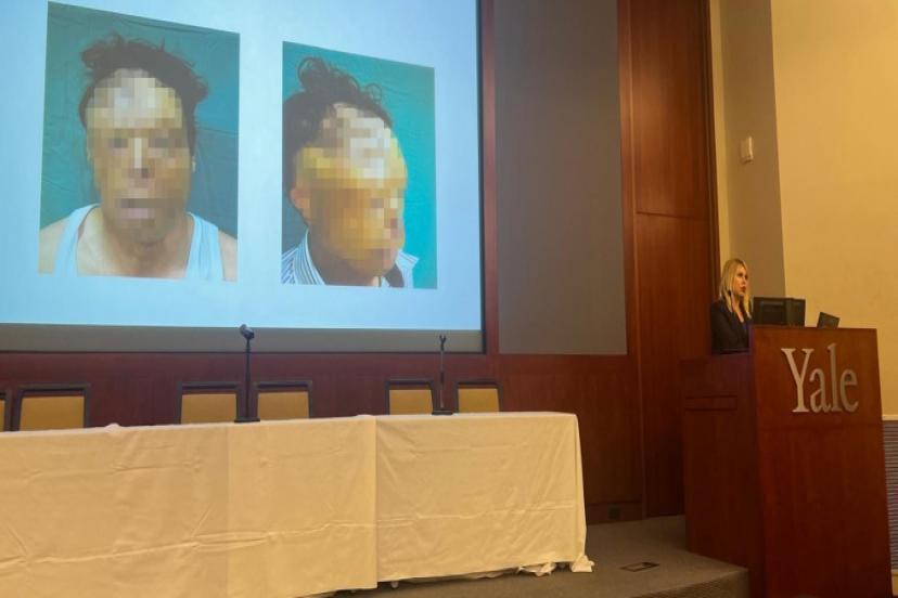 ÖZKAN, TÜRKİYE’NİN SAĞLIK ALANINDAKİ BAŞARISINI ANLATTI