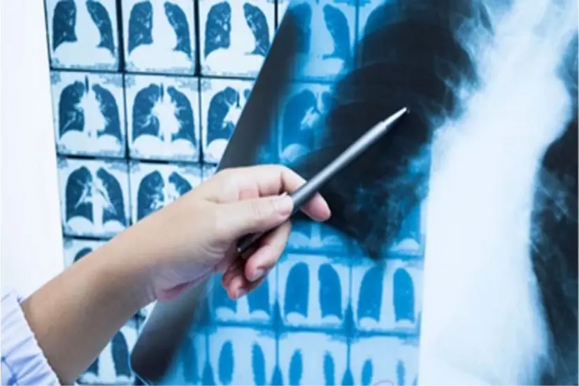 TÜMOR SANDIKLARI PARÇA ACI BİBER ÇIKTI